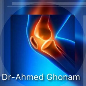 عيادة الركبة والرباط الصليبي